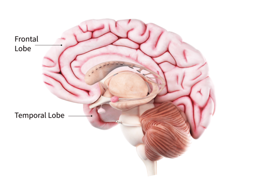 frontal lobe dementia symptoms